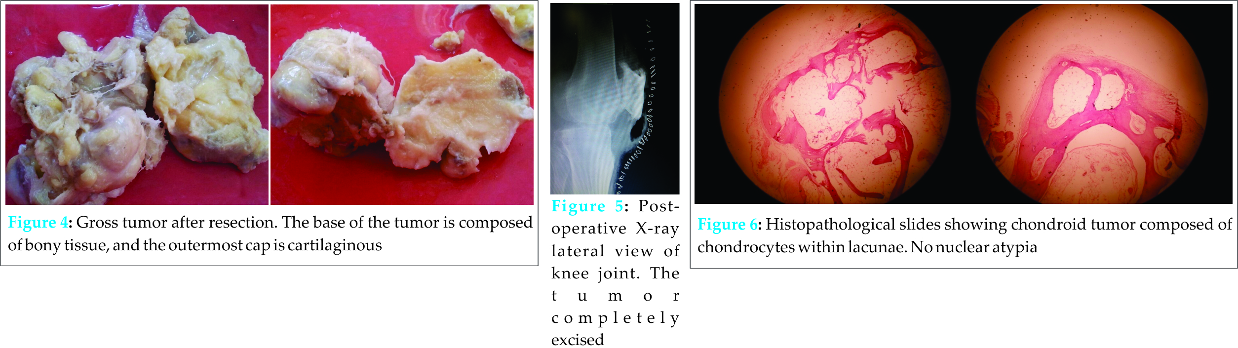 Fig 4-6