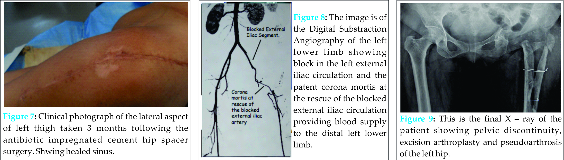 Fig 7 8 9