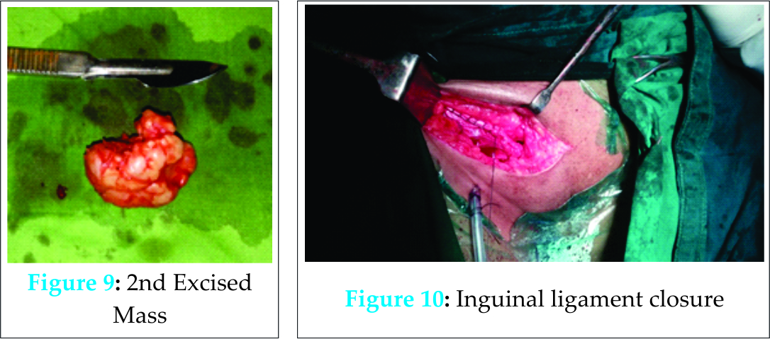 Fig 9-10