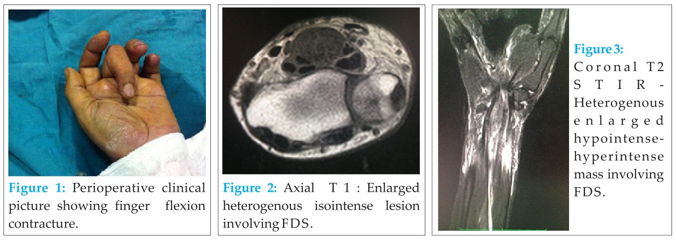 Figure 1 2 3