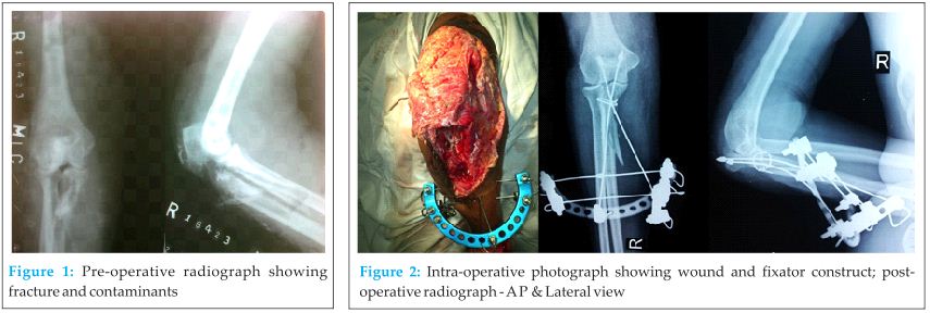 Figure 1 & 2