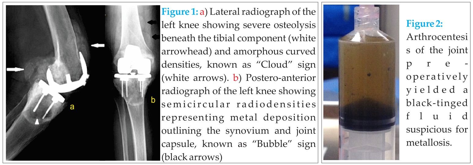 Figure 1 2