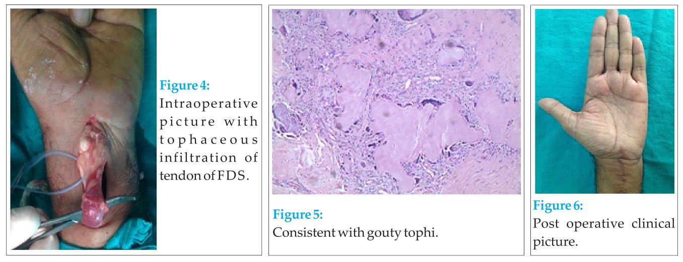 Figure 4 5 6