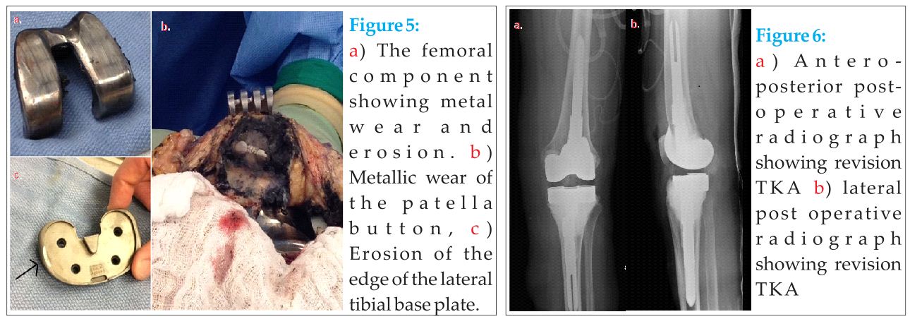 Figure 5 6